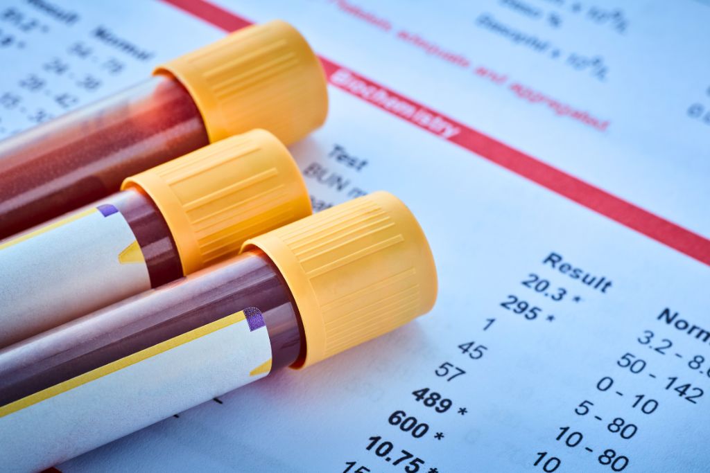 Close-up of blood sample vials on top of lab test results—used to illustrate blood tests without a referral for health and fitness insights.