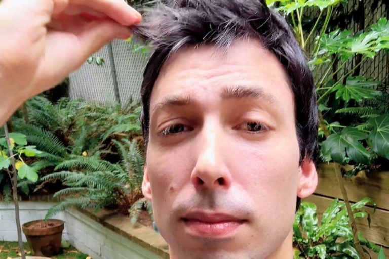 TCM practitioner pulling hair in frustration, asking: can hair loss be reversed?