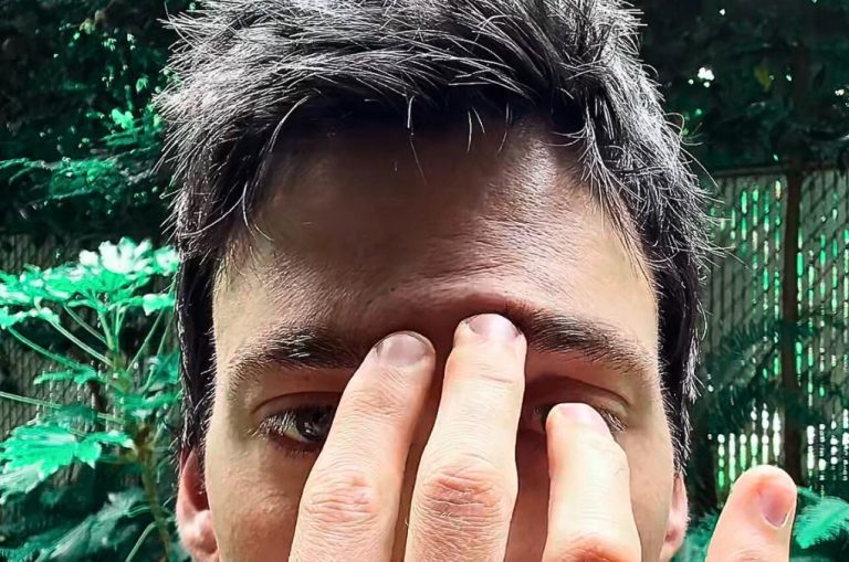 Man pressing acupressure point between eyebrows, exploring the link between stress and hair loss — can hair loss be caused by stress?